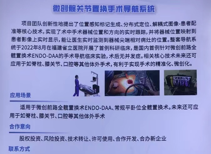 髋关节置换手术导航系统